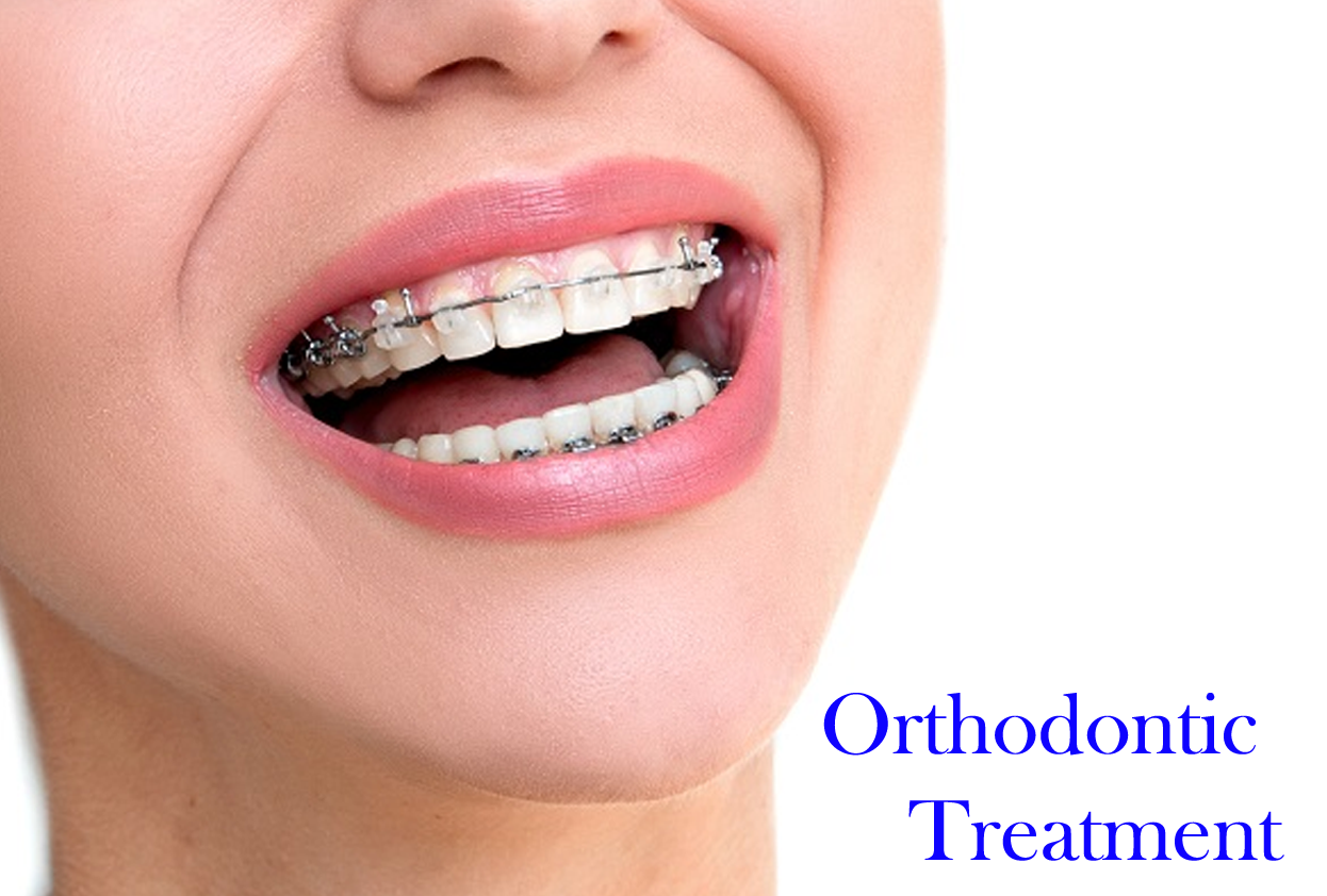 Orthodontic Treatment